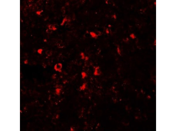 Immunofluorescence of ZIP5