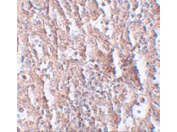 Immunohistochemistry of ZIP5