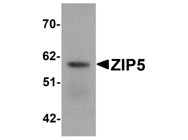 Western blot of ZIP5