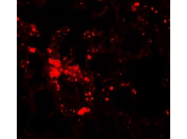 Immunofluorescence of ZIP6