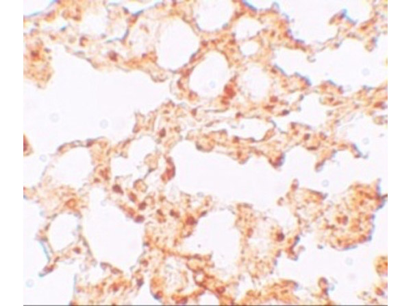 Immunohistochemistry of ZIP6