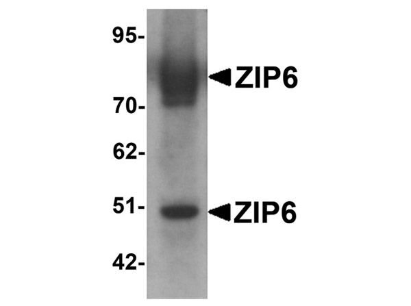 Western blot of ZIP6