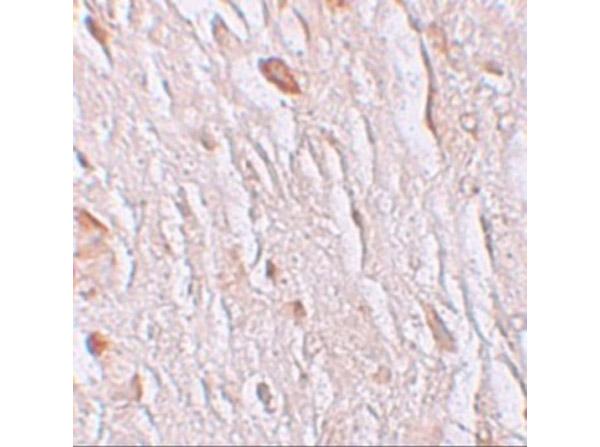 Immunohistochemistry Validation of ZIP7