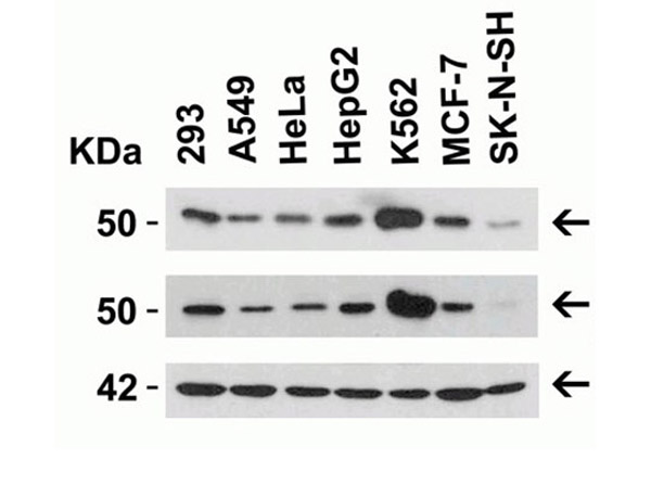 Western Blot of ZIP7