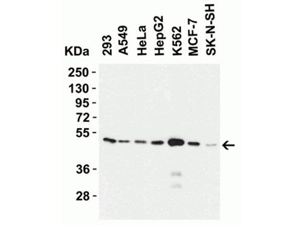 Western Blot of ZIP7