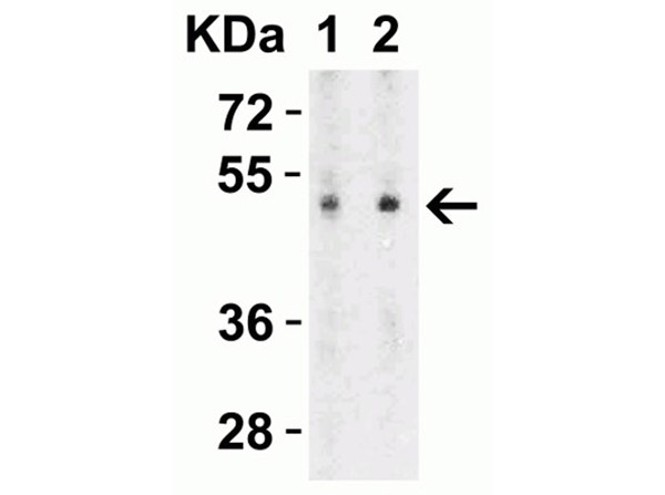 Western Blot of ZIP7