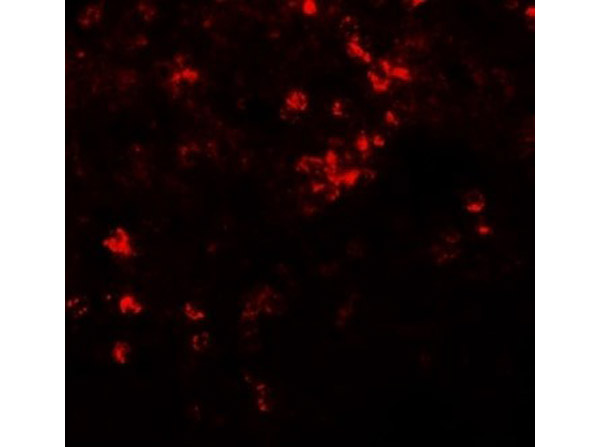 Immunofluorescence of ZIP8