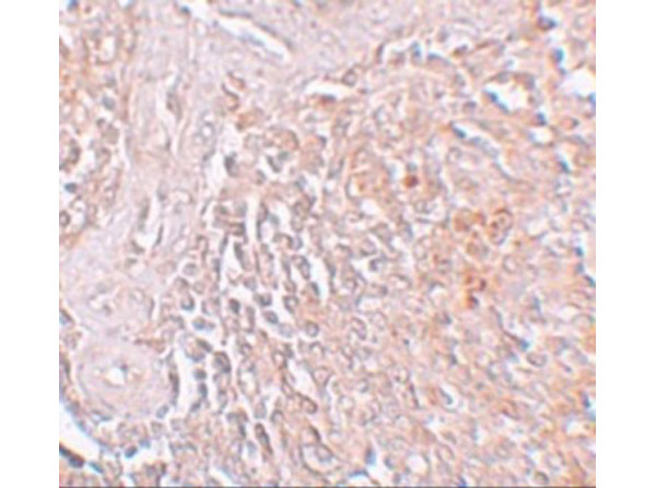 Immunohistochemistry of ZIP8