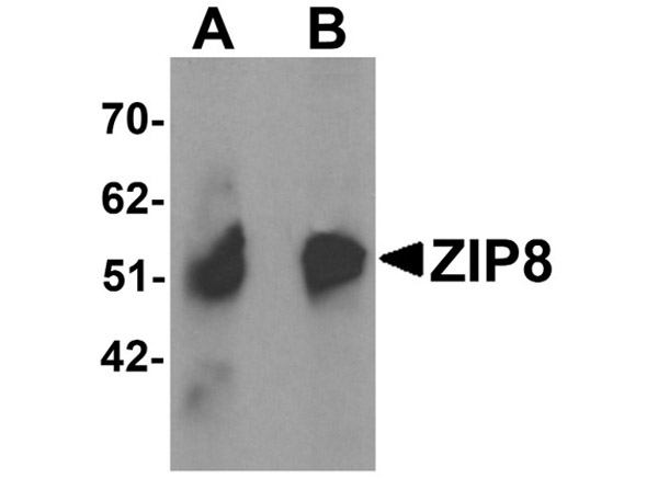 Western blot analysis of ZIP8