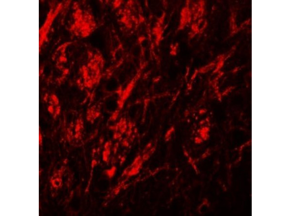 Immunofluorescence of ZIP9