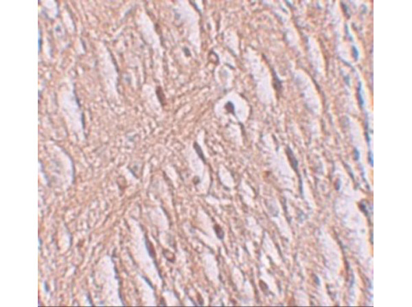 Immunohistochemistry of ZIP9