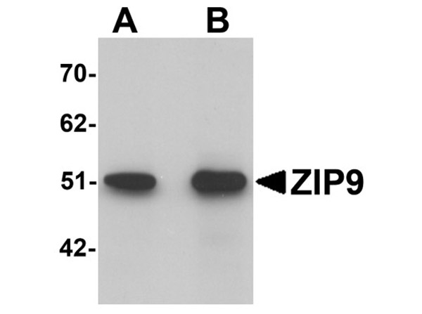 Western blot analysis of ZIP9