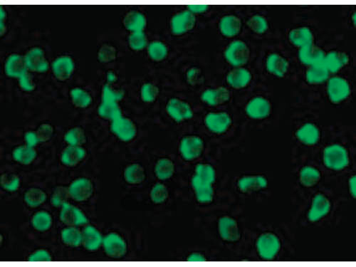 Immunofluorescence of ZIPK Antibody