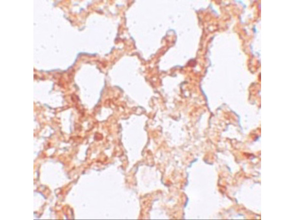 Immunohistochemistry of ZMYM1