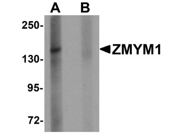 Western blot analysis of ZMYM1