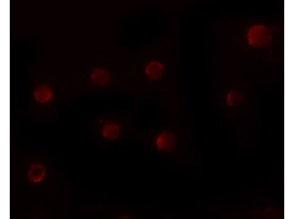 Immunofluorescence of ZMYM2