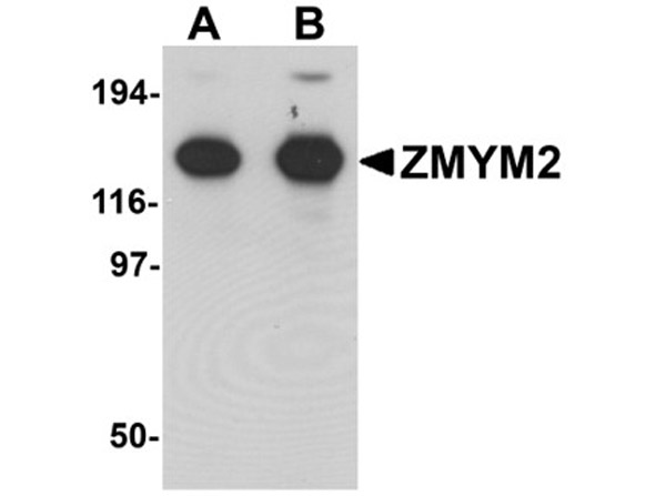 Western blot analysis of ZMYM2