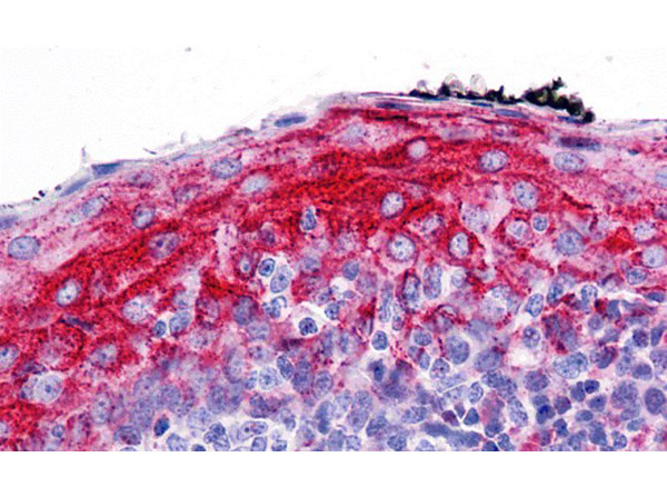 Immunohistochemistry of ZMYM4