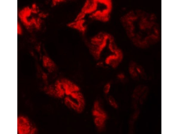 Immunofluorescence of ZNF346