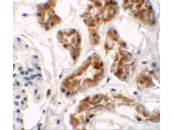 Immunohistochemistry of ZNF346 (CT)