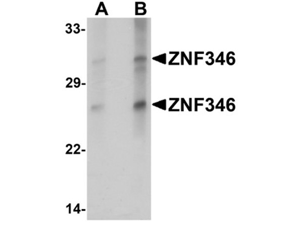 Western blot analysis of ZNF346