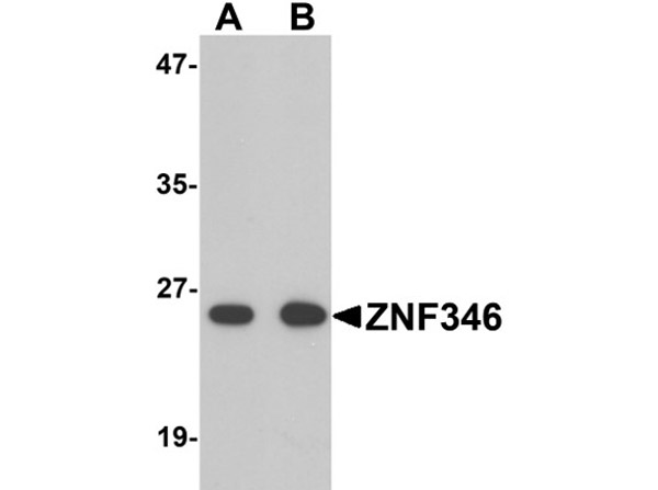 Western blot of ZNF346