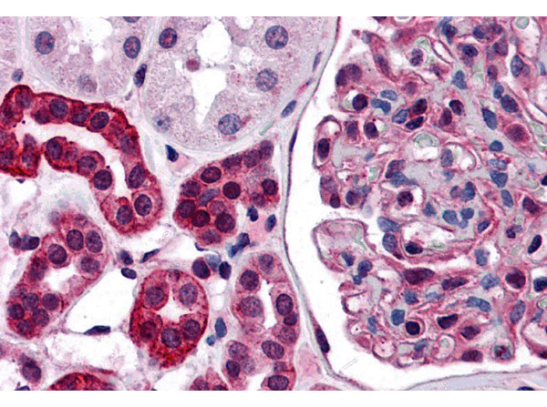 Immunohistochemistry of ZNF521