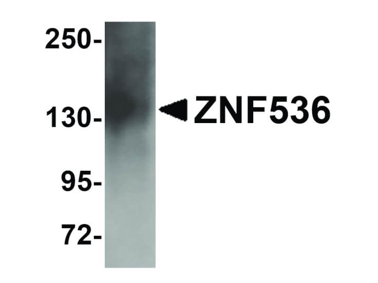 Western Blot of ZNF536 Antibody