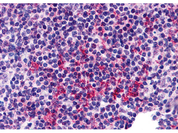 Immunohistochemistry of ZNF687