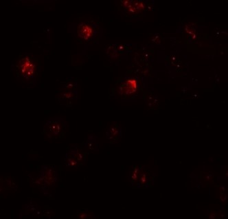 Immunofluorescence of ZNF687