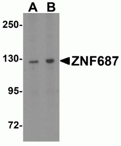 Western blot analysis of ZNF687