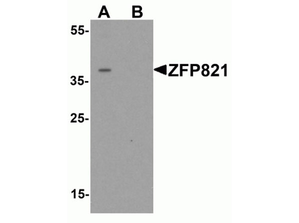 Western blot of ZNF821