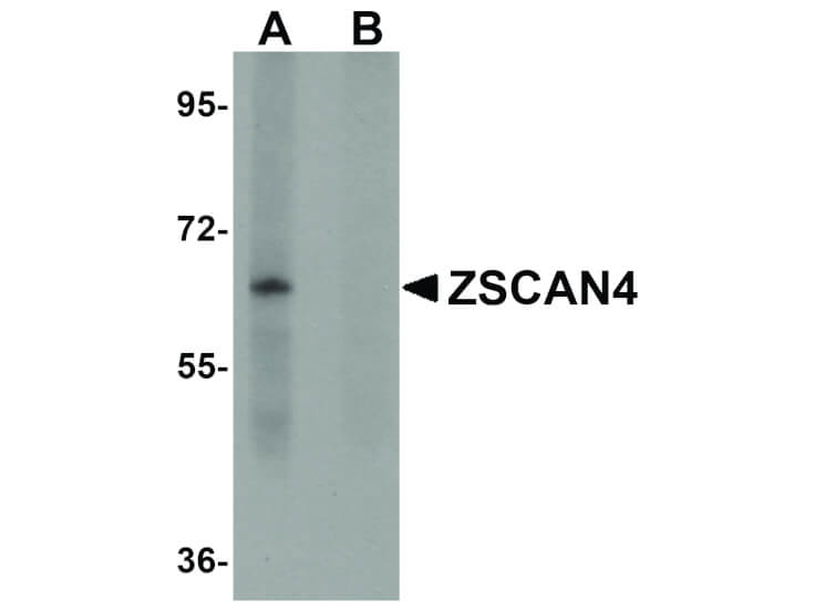 Western Blot of ZSCAN4 Antibody