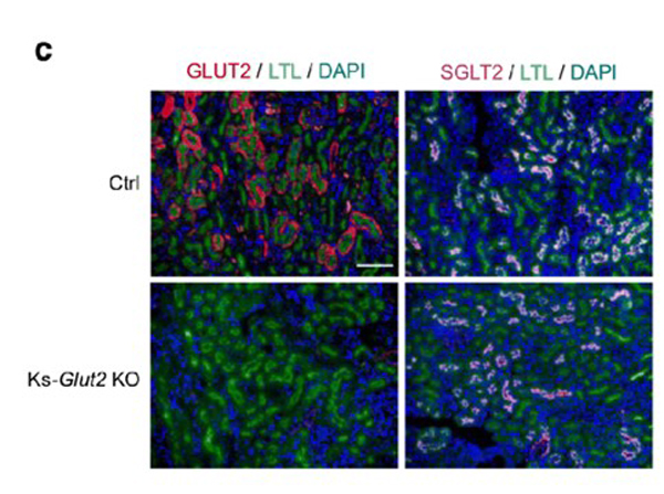 Immunofluorescence using GLUT2