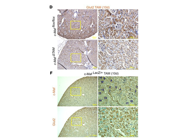 Immunohistochemistry using GLUT2