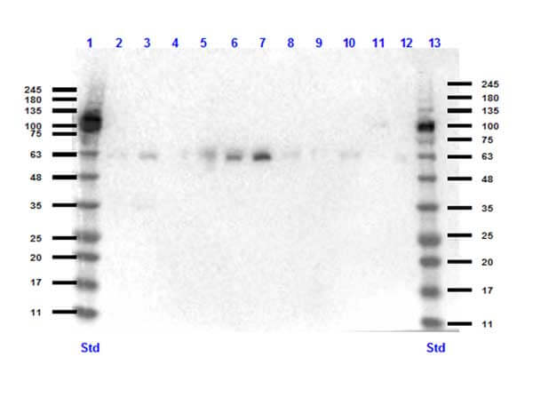 Western Blot of Rabbit anti-KLF4 antibody