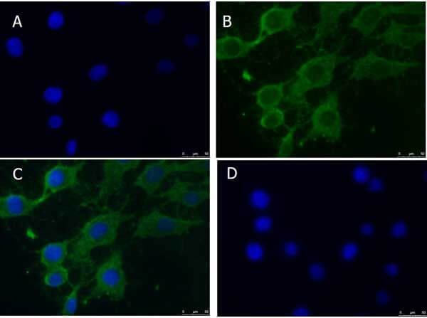 Immunofluorescence Microscopy of Rabbit anti-PINK1 antibody