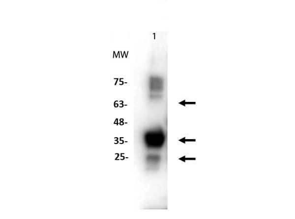 Western Blot of Rabbit anti-PINK1 antibody