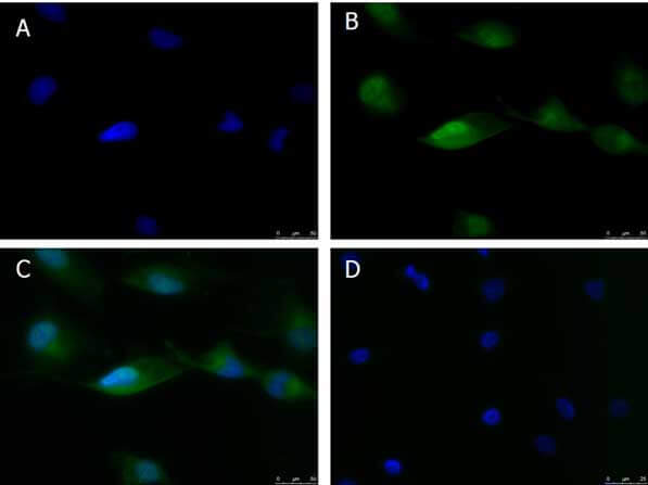 Immunofluorescence of Anti-ATF6 (RABBIT) Antibody