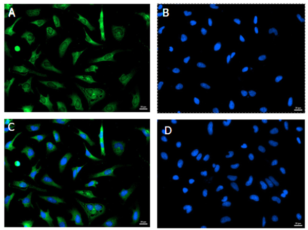 GAPDH Antibody