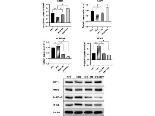Western Blot using SIRT1