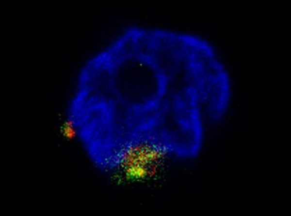 Immunofluorescence of Rabbit Anti-NGP