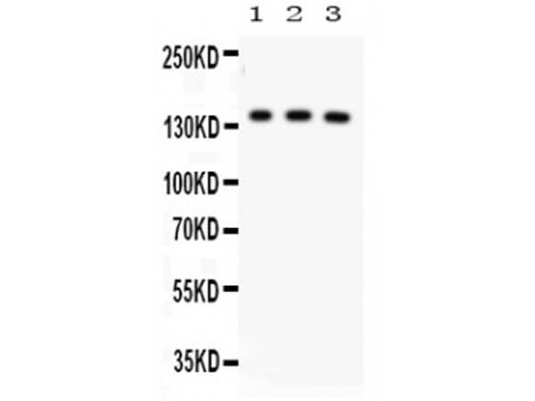 Western Blot of Anti-ABCB11 Antibody.