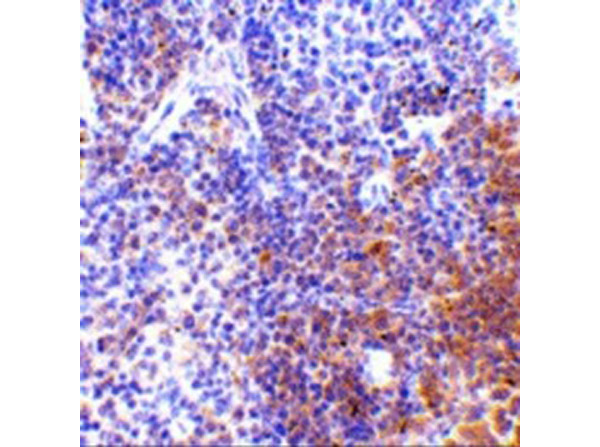 Immunohistochemistry of IRF7