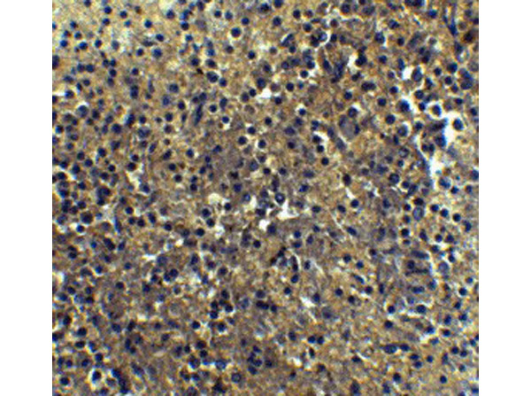 Immunohistochemistry of IRF7