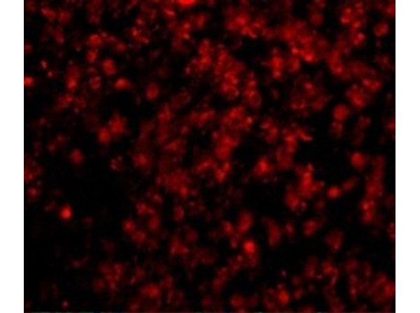 Immunofluorescence of Lipe