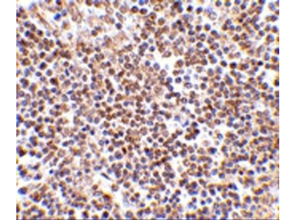 Immunohistochemistry of Lipe