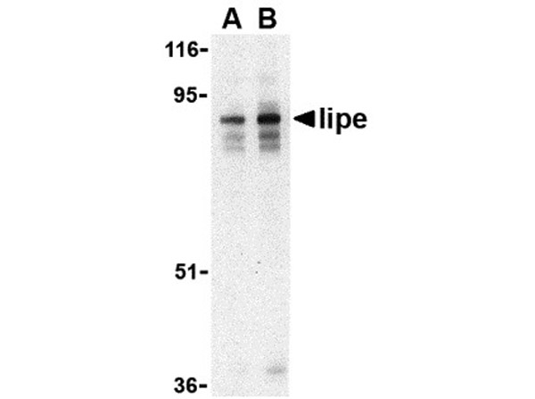 Western blot of Lipe