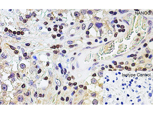 Immunohistochemistry of NANOG