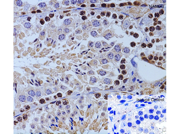 Immunohistochemistry of NANOG